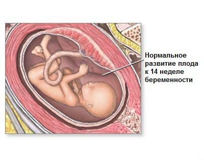 14 неделя беременности 14 неделя беременности